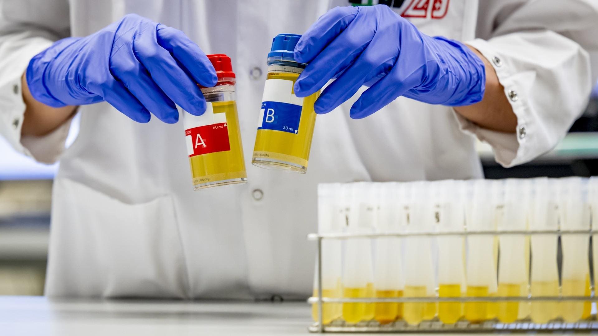 Naming Doped Athletes Online Must Pass a Privacy Test